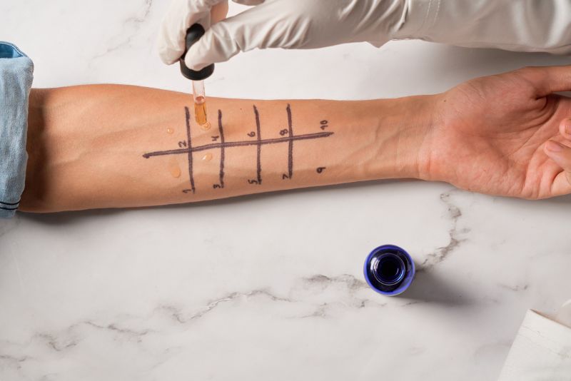 Allergy Testing in Glendale & Burbank, CA - Southern California ENT and Allergy Associates