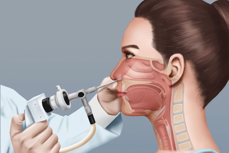 Nasal Endoscopy in Glendale & Burbank, CA - Southern California ENT and Allergy Associates
