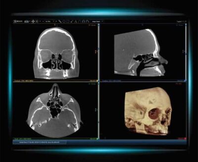 Mini CAT Scan Glendale & Burbank, CA -SCENTAA